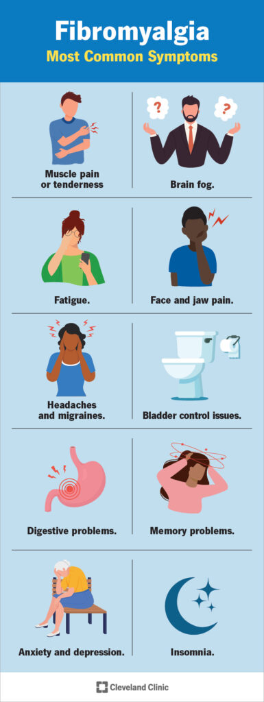 Fibromyalgia Symptoms Infographic provided by Cleveland Clinic