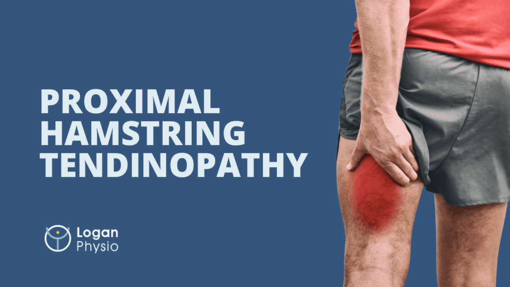Proximal Hamstring Tendinopathy