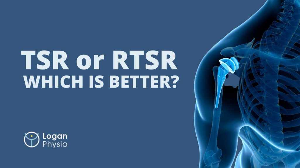 TSR or RTSR