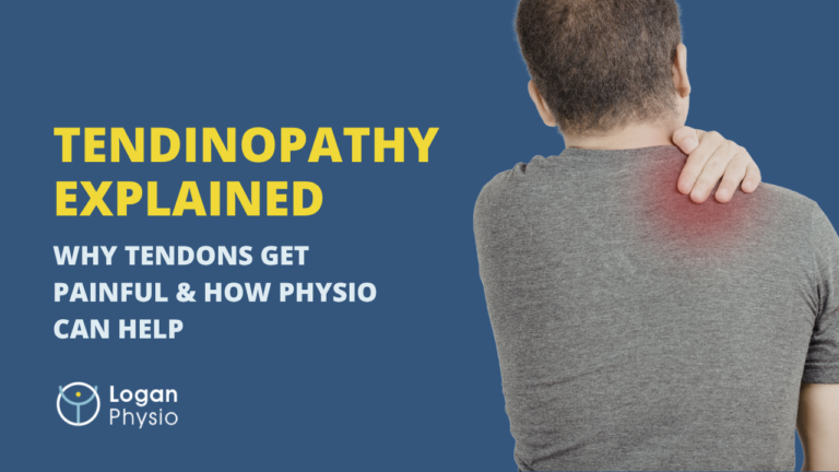 Tendinopathy Explained: Why Tendons Get Painful and How Physiotherapy Can Help