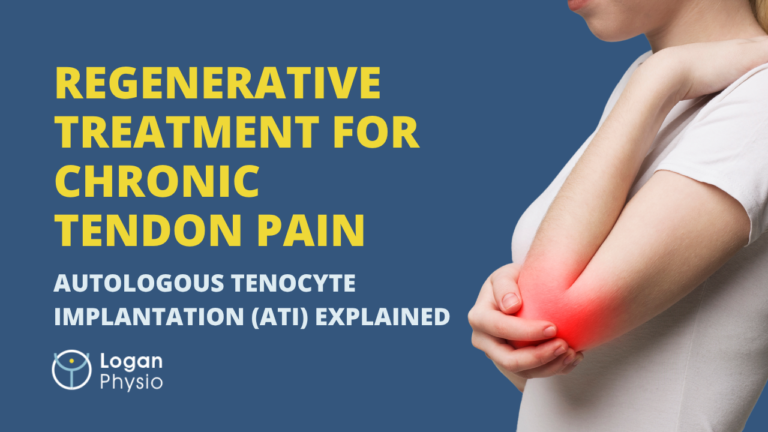 Regenerative Treatment for Chronic Tendon Pain: Autologous Tenocyte Implantation (ATI) Explained
